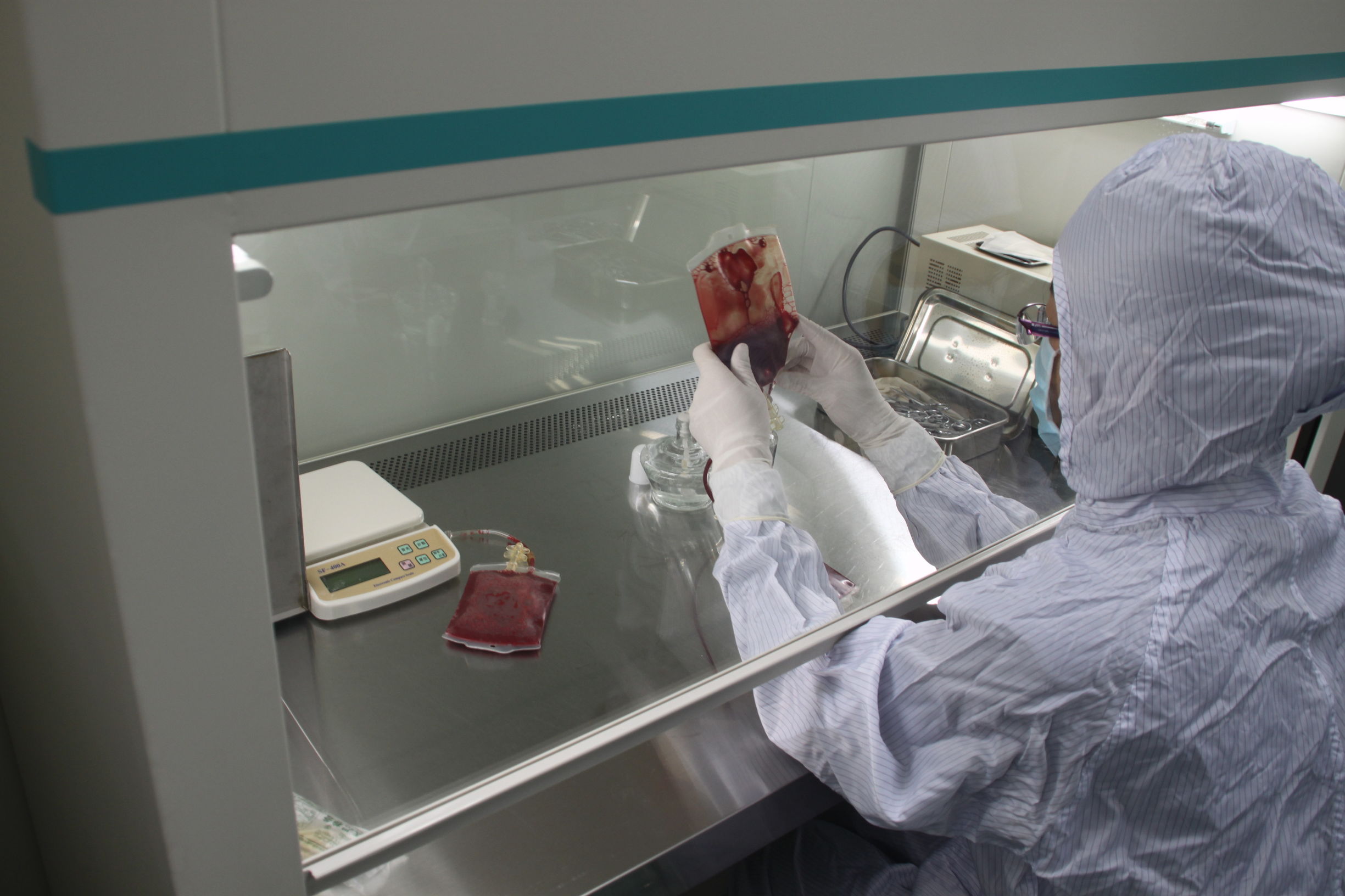 现在脐带血有保存的必要吗,脐带血有没有必要保存