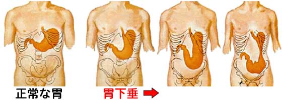 手掌手指长疣是什么原因,手掌比手指长怎么回事