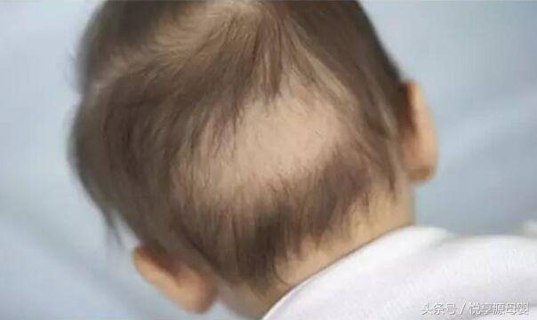 三岁多小孩睡觉满头汗怎么回事,宝宝睡觉背上汗多是什么原因