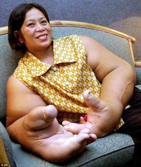 如此大的器官怎么长的，都打碎吉尼斯记录了，看到第一个已我服了