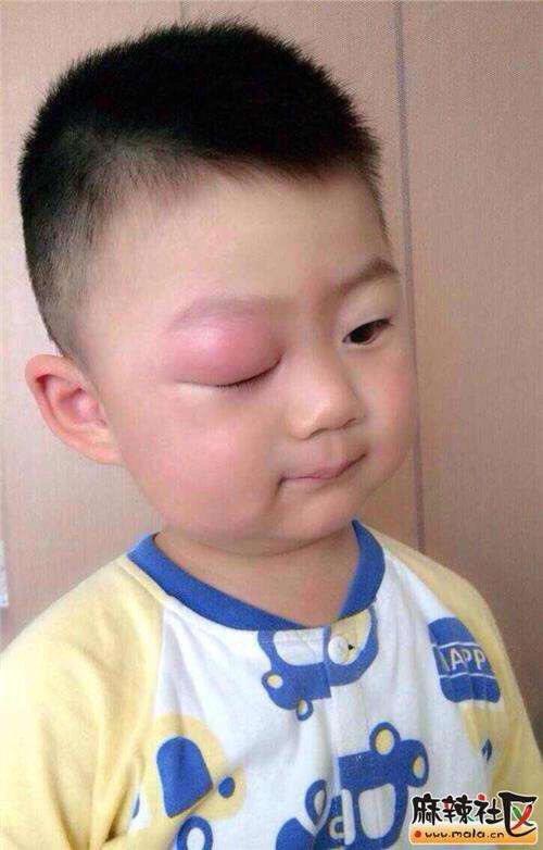 驱蚊液成分怎么选,驱蚊液关注事项避免儿童接触