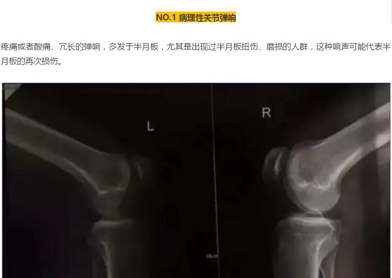 健身关节响怎么训练,健身时关节响什么原因