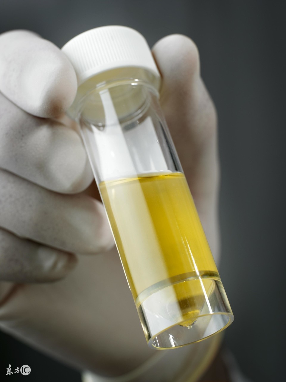 过敏性紫癜引起的尿潜血怎么治疗,过敏性紫癜隐血弱阳性说明了什么