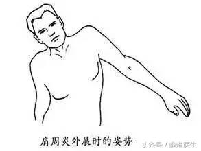 颈椎疼肩周炎腰痛一个动作全解决,肩周炎正确锻炼方法5个动作视频