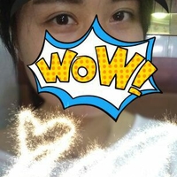 双眼皮松弛全切恢复过程,全切双眼皮几天可以洗脸