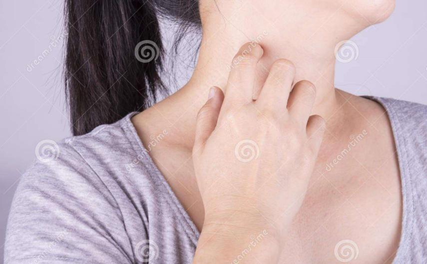 全世界得湿疹的人有多少,湿疹几乎人人都得过