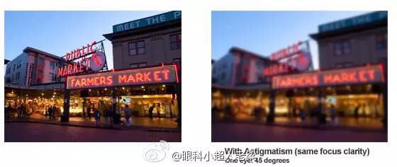 宝宝散光老母亲焦虑,孩子散光几岁治疗最好