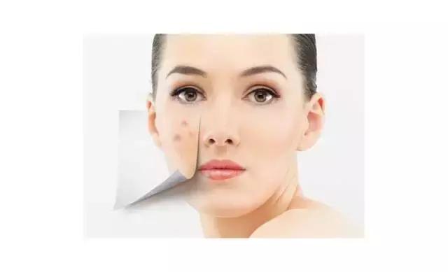 用完菌菇水爆痘,菌菇水对痘印有效果没