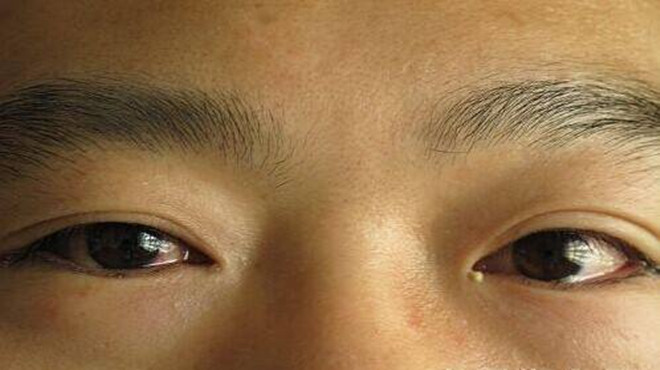 眼屎有什么秘密,眼屎是眼睛的脏东西