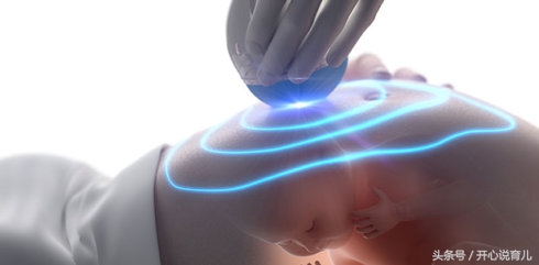 孕妇四维彩超跟大排畸有什么区别,孕期四维大排畸几周做最合适