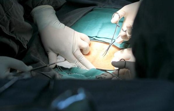 剖腹产全部流程记录,顺产剖腹产的十个真相