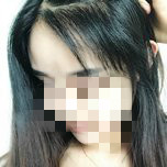 大额头适合用什么植发,大额头发际线高怎么办