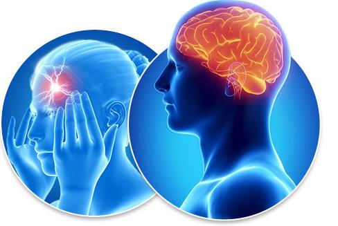 神经性头痛拔罐哪几个穴位,神经性头痛针灸穴位