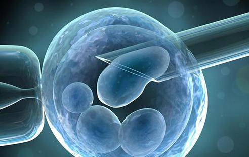 试管婴儿答疑解惑,有关试管婴儿有趣问题