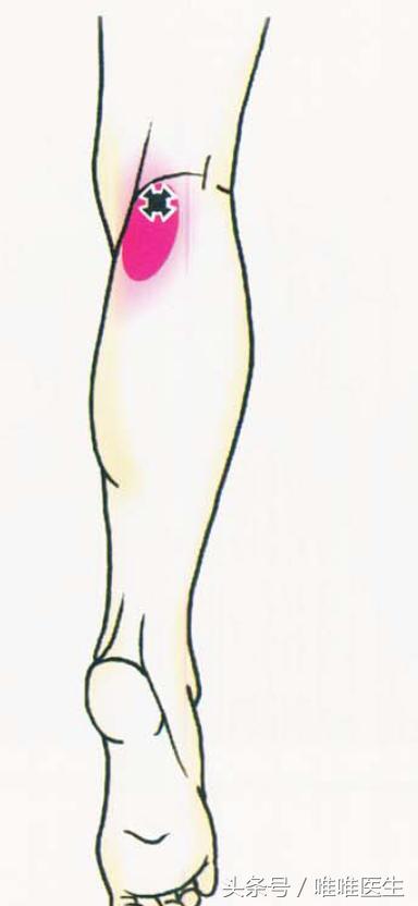 绝对干货膝盖损伤知识一网打尽,膝关节疼痛知识科普