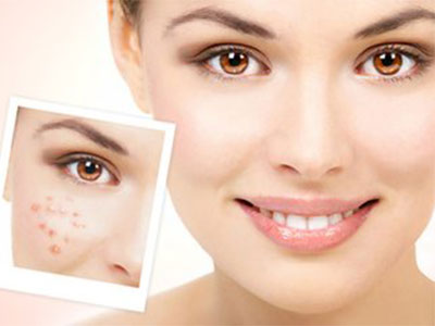 皮肤科医生建议淡化痘印的方法,顽固痘印怎么祛除医美