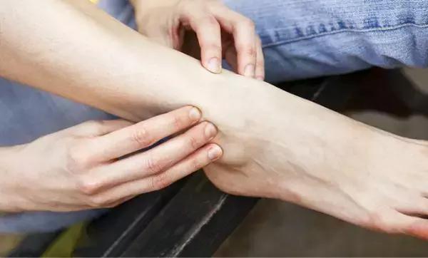 易水肿体质为什么能水肿好几天,为什么有的人会经常全身水肿