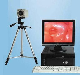 人工干扰素治疗hpv感染效果怎么样,hpv感染身上长了好多疣体怎么治疗