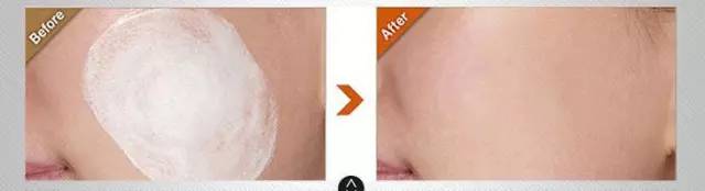 紧急解决多区域频繁爆痘 (反反复复爆痘怎么办)