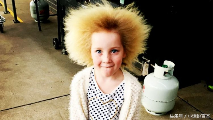 澳大利亚女性蓬发综合症,澳大利亚女孩难梳头发综合征