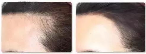 刘诗诗杨幂唐嫣四大小花旦,杨幂唐嫣刘诗诗谁输得最惨