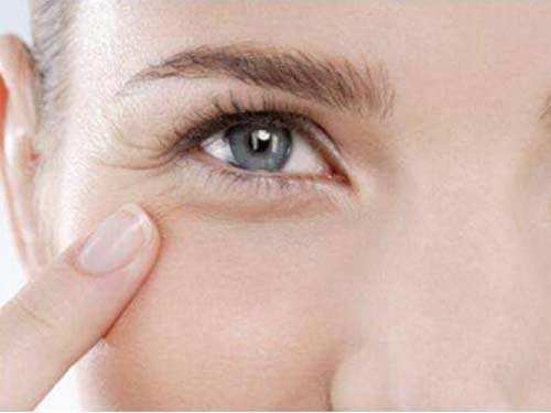 有效去除眼纹皱纹,除眼皱纹最好的办法