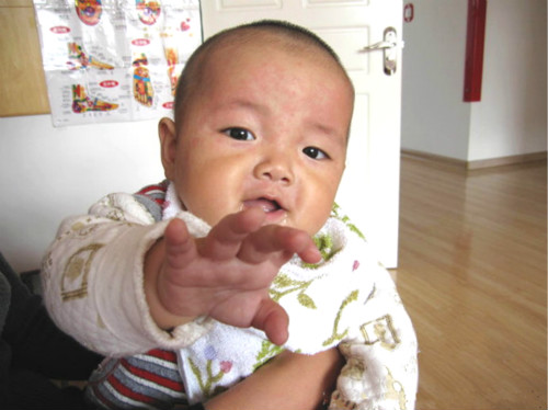 幼儿急疹会引起高热惊厥吗,小孩发烧39.7高温惊厥