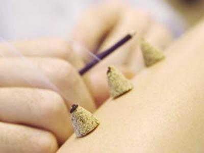 艾灸疗法的关注事项有哪些,艾灸疗法超有效