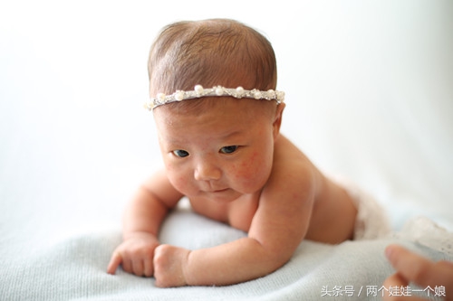 新生儿头部血肿医生有责任,新生儿头皮血肿权威专家