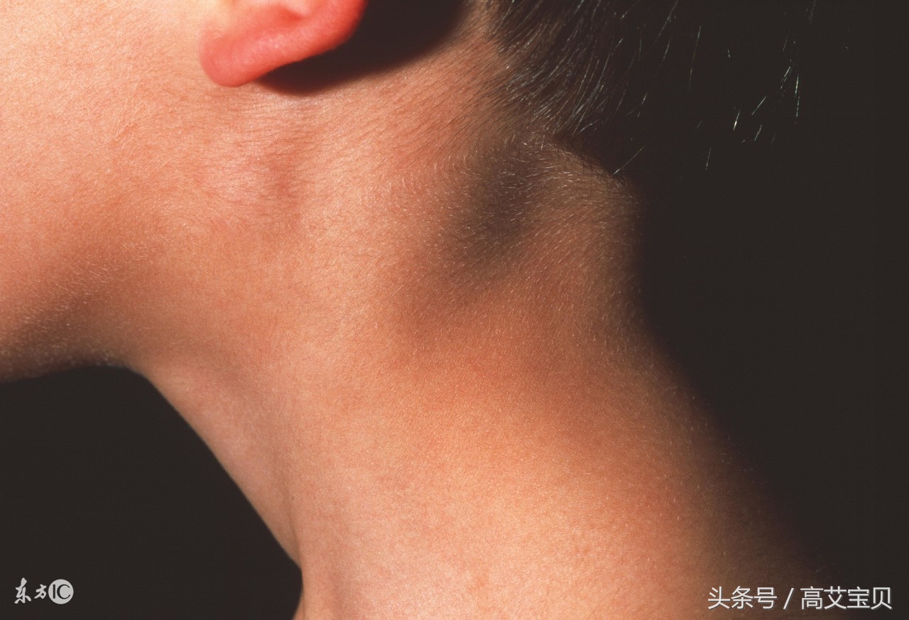 肝郁脾虚怎样做心理疏导,疏导肝郁的药