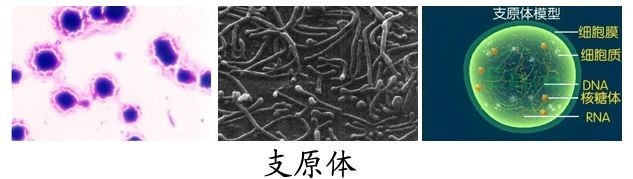 支原体感染女性妇科严重吗,女性支原体感染怎么治疗呢