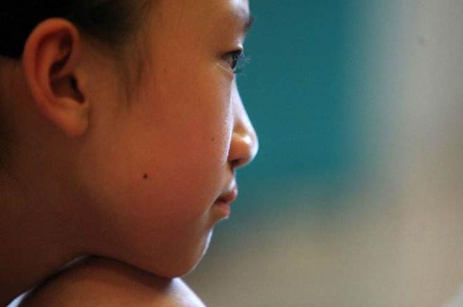 心理性失语症能治好吗,缄默症失语恢复