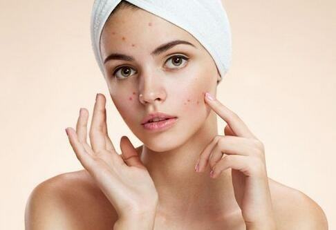 夏天脸上长痘怎么治,脸上长火气痘怎么快速消除