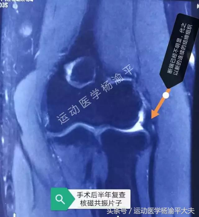 钓鱼和跑步冲突,钓鱼和打台球哪个好玩