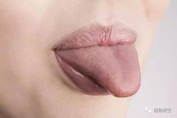 舌苔发白是怎么回事从舌苔看健康,舌苔厚白舌苔厚腻有裂纹