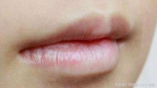 纹唇后的晕色期是什么意思,眉眼凹陷怎么修复