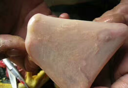 鸡白色念珠菌用什么药,白色念珠菌是什么原因形成的