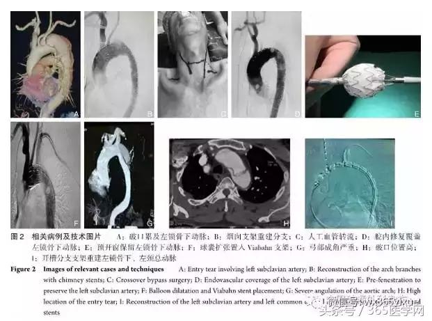 黄建华肿瘤,黄建华治胃病的视频