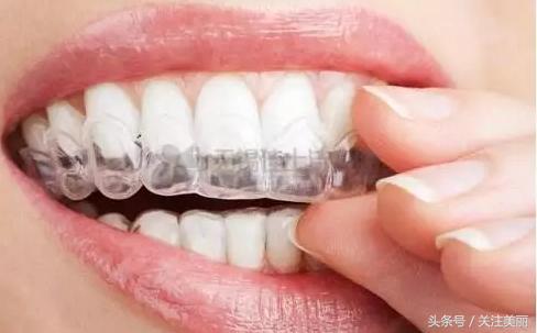 戴了牙套后嘴唇会变薄吗,戴牙套后会导致嘴变凸吗