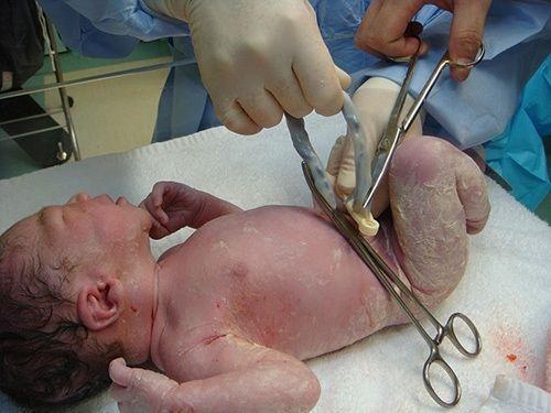 剖腹产全部流程记录,顺产剖腹产的十个真相