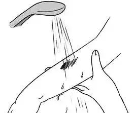 夏天狂犬病高发期！刚打的狂犬疫苗又被狗咬伤，怎么办？