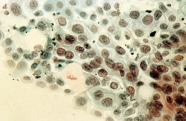 科学家发现恐龙蛋化石,科学家们发现了恐龙的证据