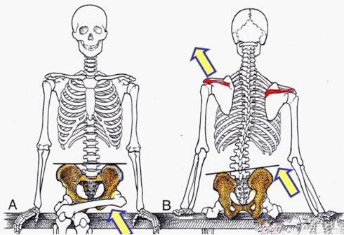 腰痛真的是腰的问题吗,原来这才是腰痛的罪魁祸首