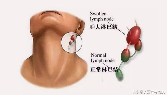 58岁医生每天“打坐”20分钟，成功延长癌症存活期！