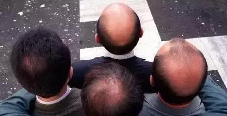 脱发毛囊要怎么修复,脱发如何使毛囊生发