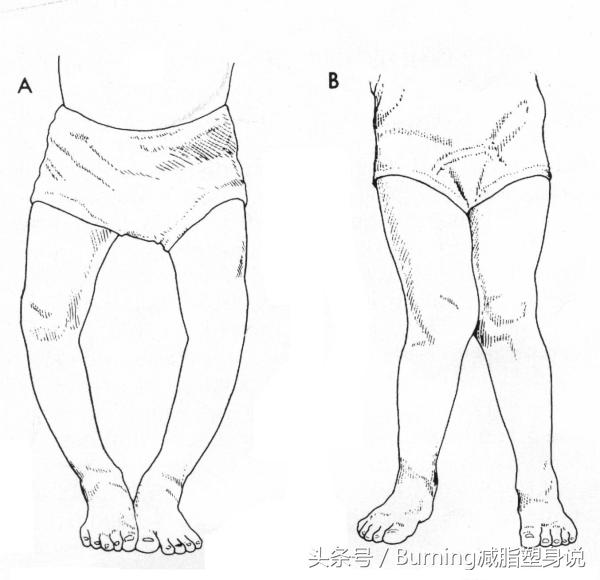 如何长高长下半身,如何再次长高长下半身