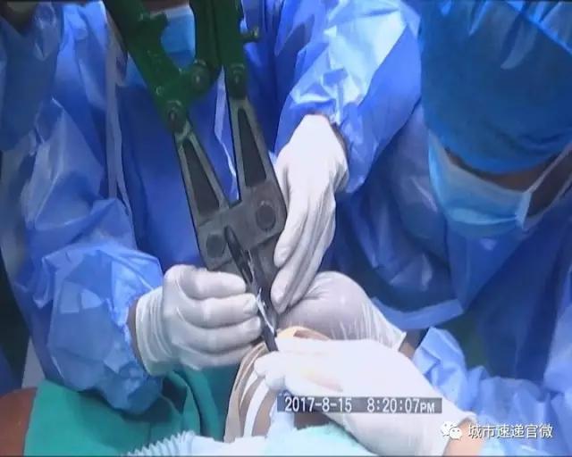 剪刀戳伤小朋友,剪刀戳伤孩子