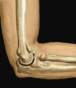 4岁左桡骨小头骨皮质断裂,小孩桡骨小头发育缺失