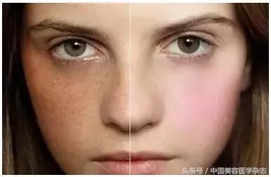 干货：治疗*褐斑黄**的神药，真的这么神奇，连美白针也有它的成份！