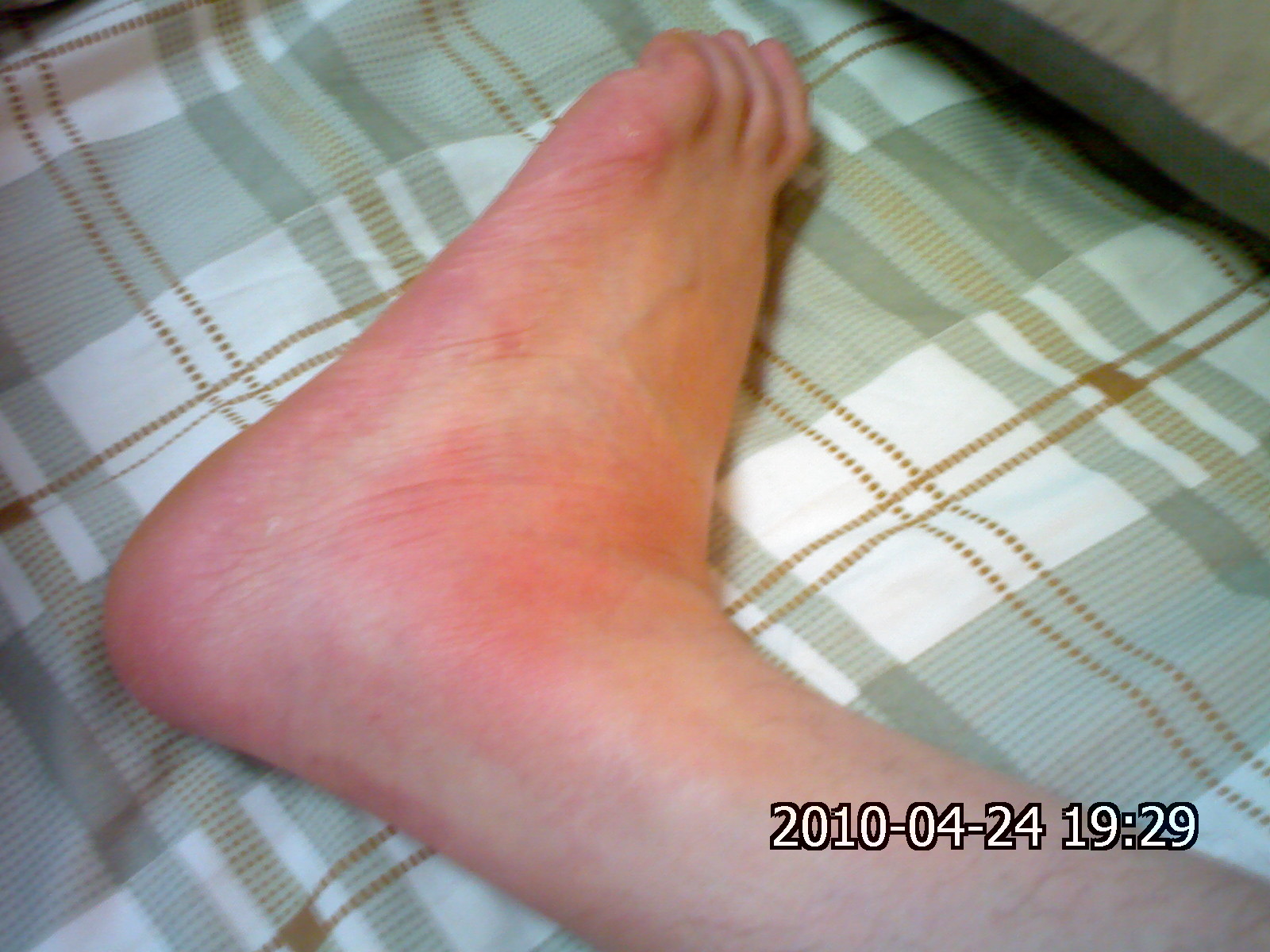 痛风患者六不宜痛风病友要牢记,医生说痛风最好忌口